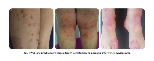 Zdjęcie przed i po