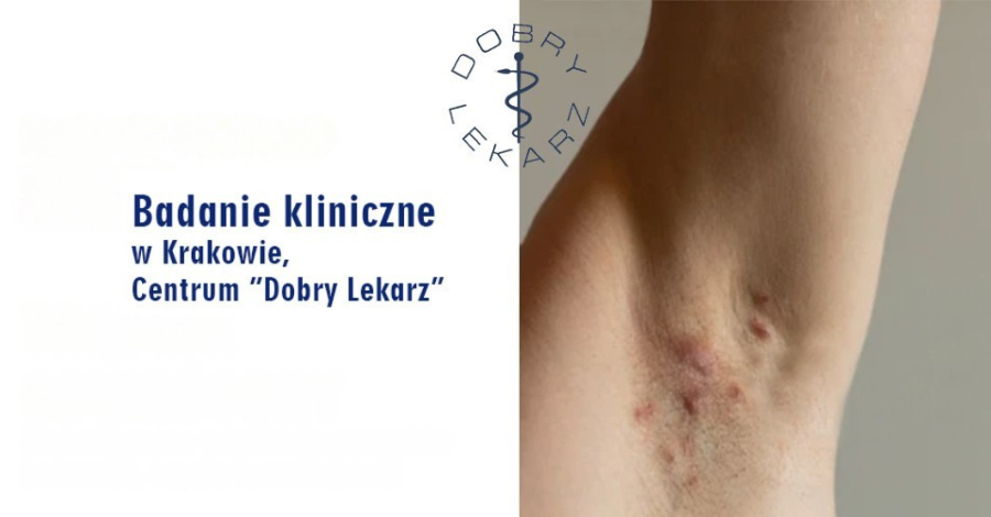 Badanie Kliniczne