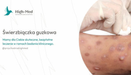 Świerzbiączka badanie nad nowym lekiem Warszawa