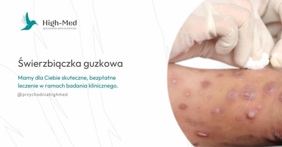 Świerzbiączka badanie nad nowym lekiem Warszawa
